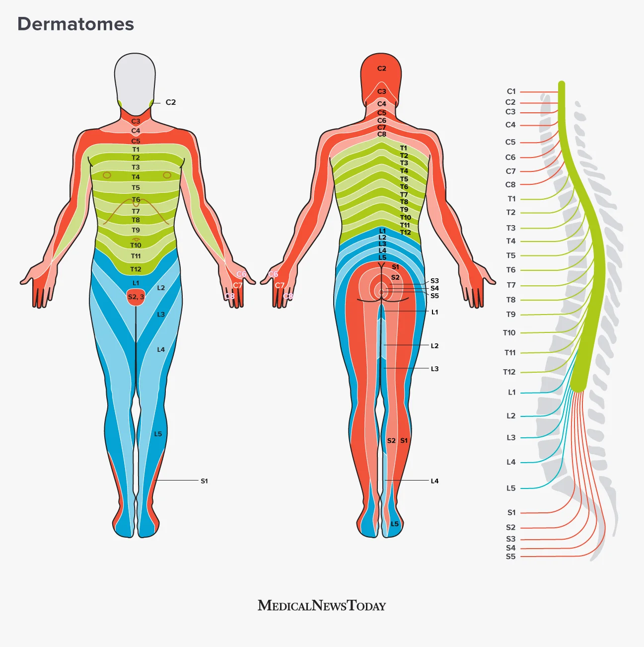 Referred Pain